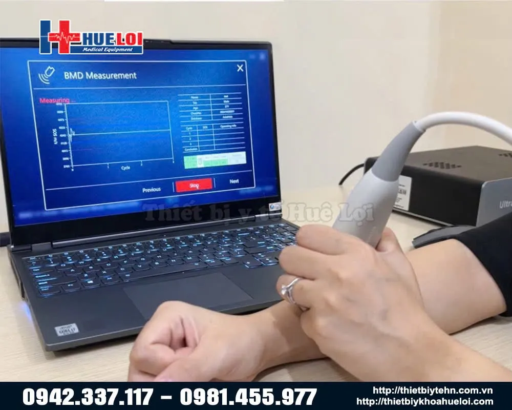 Hướng dẫn máy đo mật độ xương BMD-A1