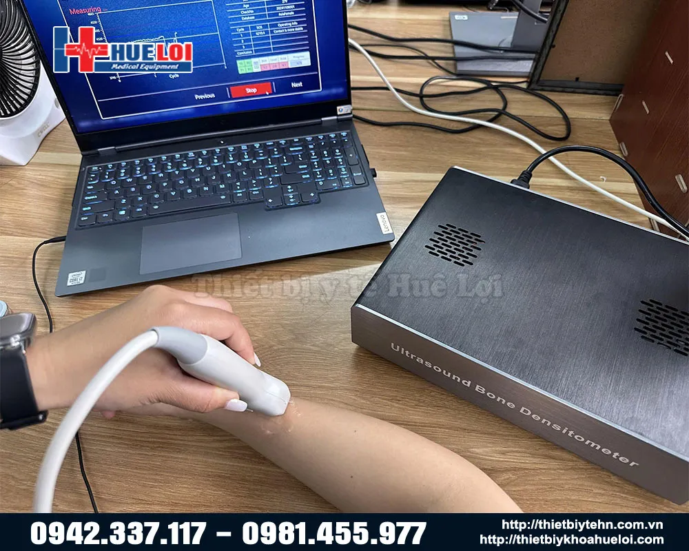 Hình ảnh thực tế sử dụng máy đo mật độ xương BMD-A1