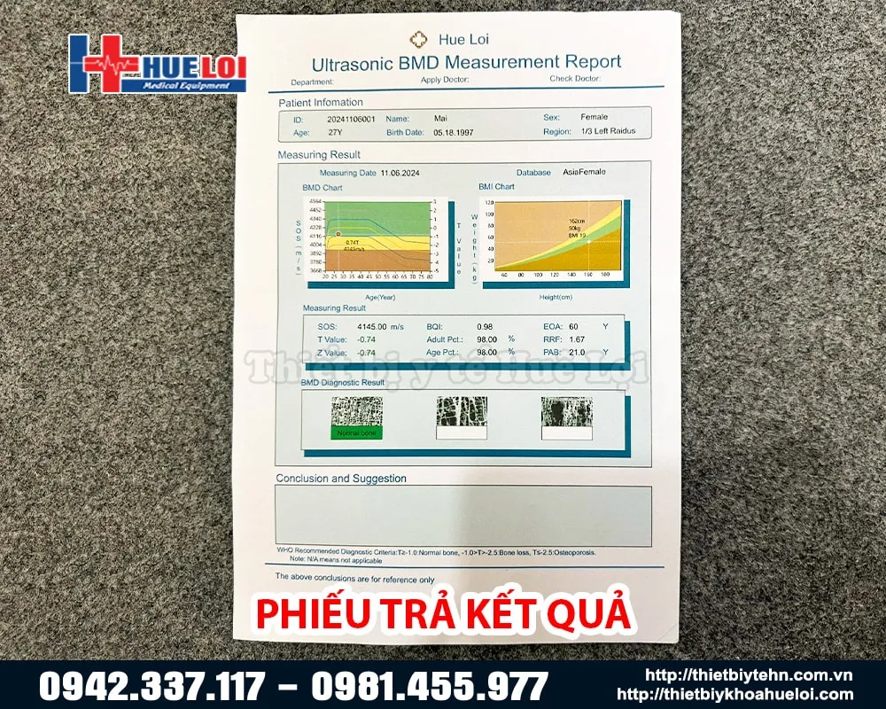 Phiếu trả kết quả mật độ đo loãng xương BMD-A1