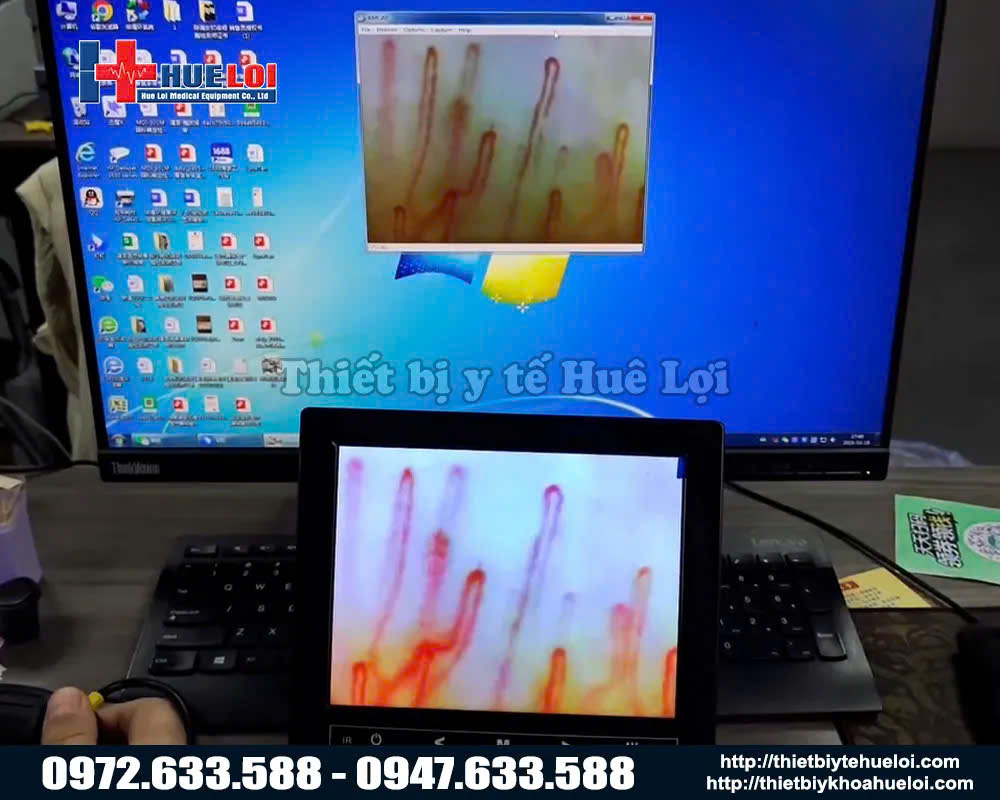 Kính soi vi tuần hoàn máu