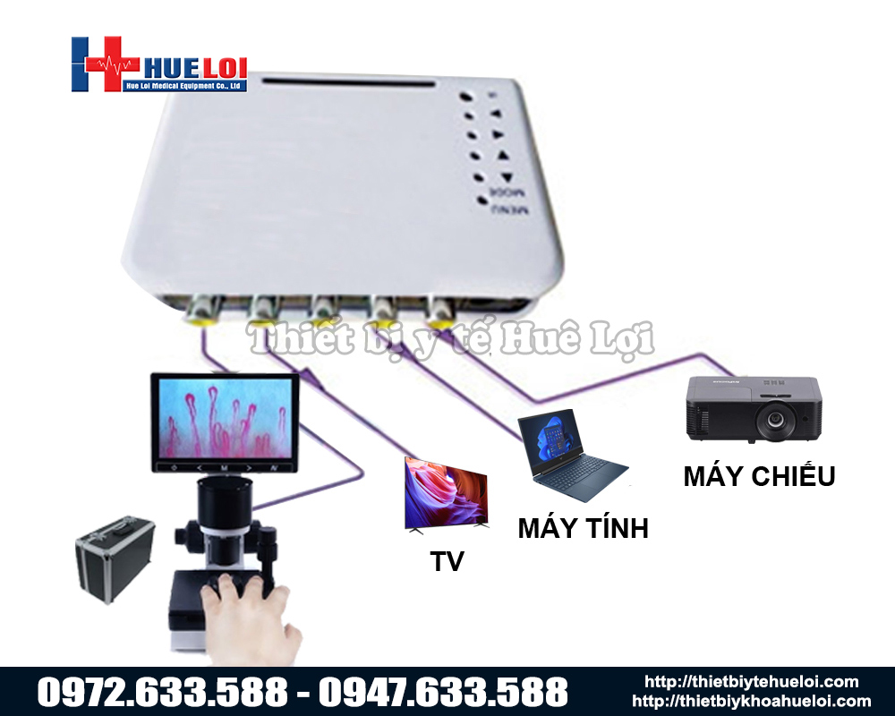 Kính hiển vi soi mạch máu có thể kết nối với màn hình ngoài