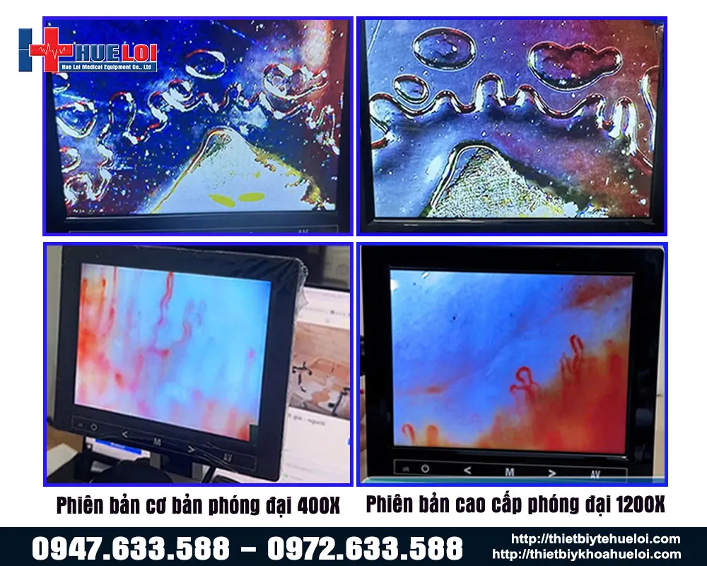 So sánh kính hiển vi phiên bản cơ bản và phiên bản cao cấp