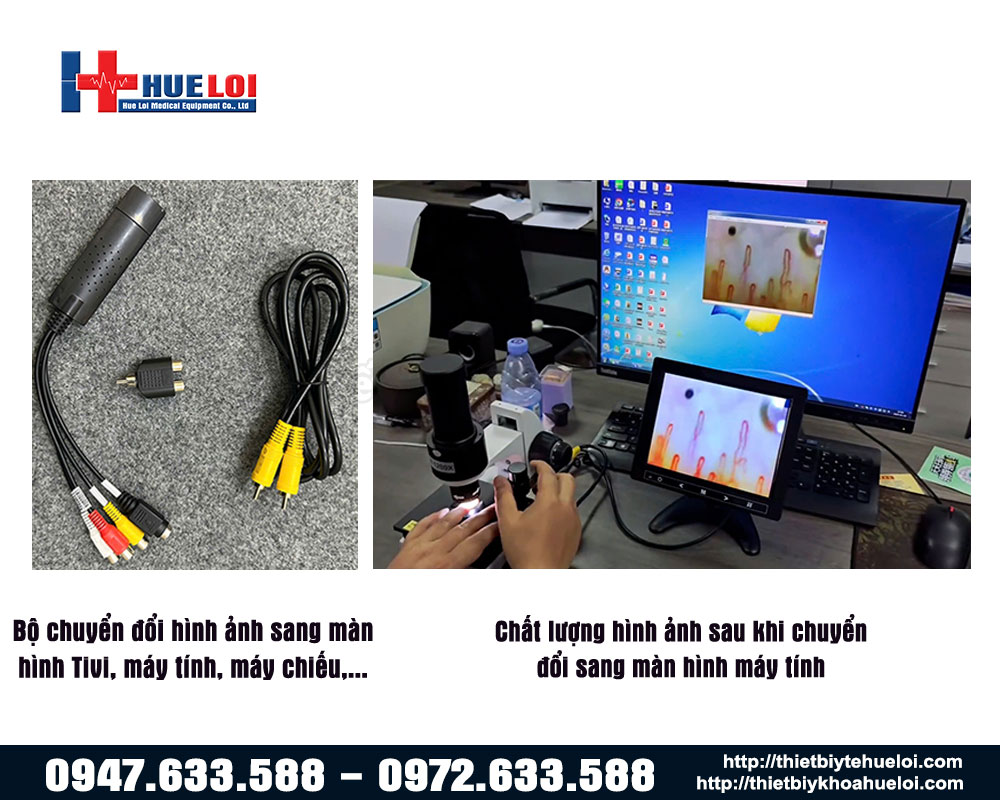 Bộ chuyển đổi hình ảnh kính hiển vi soi mạch máu cao cấp