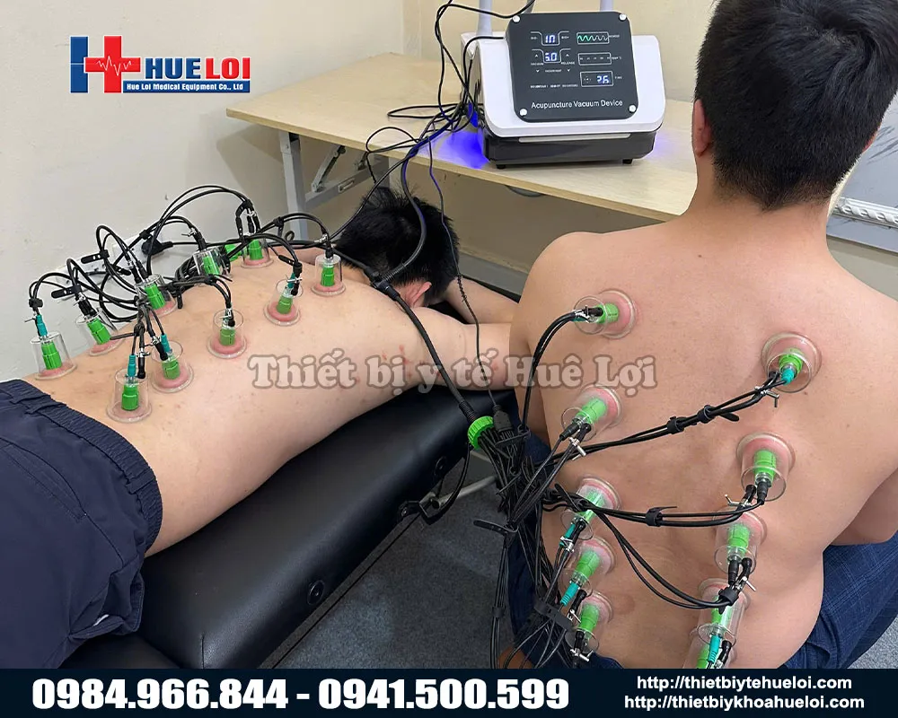 Điều trị bằng máy điện châm không xâm lấn giá rẻ
