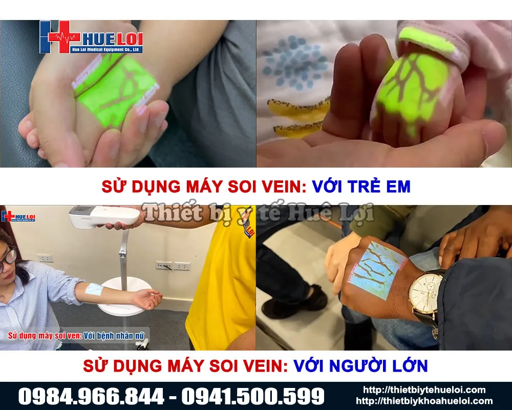 Máy soi tĩnh mạch QV-600