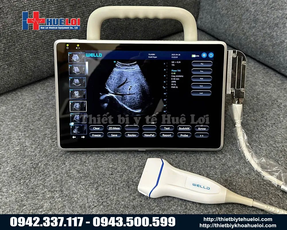 Máy siêu âm ổ bụng welld p10
