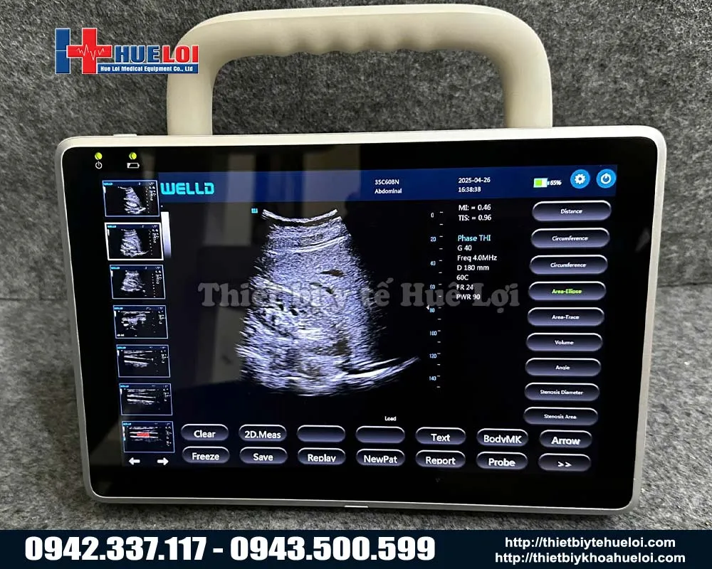 Máy siêu âm cảm ứng xách tay giá rẻ