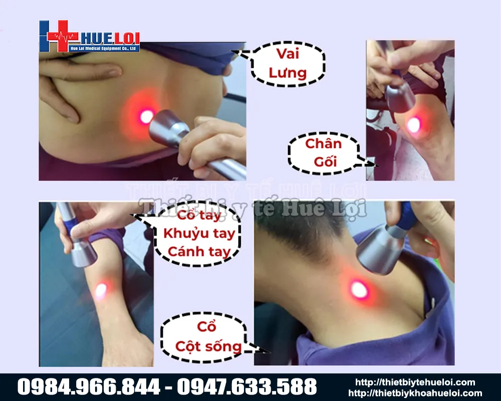 Vị trí ứng dụng máy laser EC30 đơn bước sóng trong điều trị đau cơ – xương – khớp