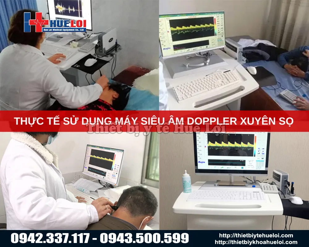 Ứng dụng của máy chẩn đoán hình ảnh xuyên sọ