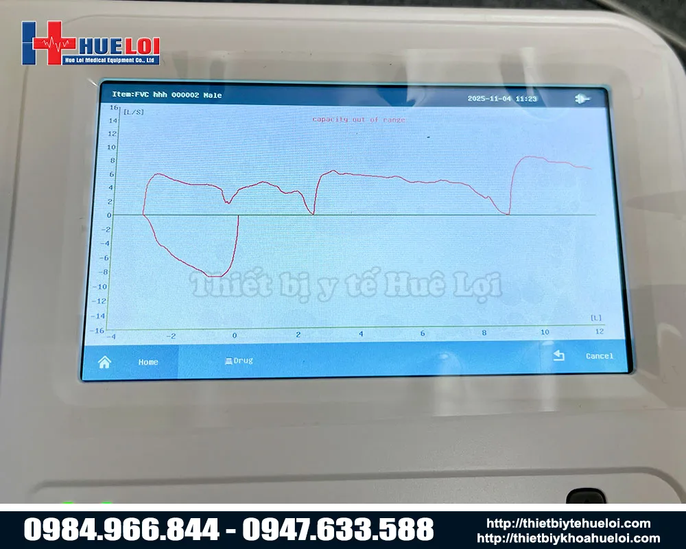 Đồ thị kiểm tra chức năng hô hấp sp 100