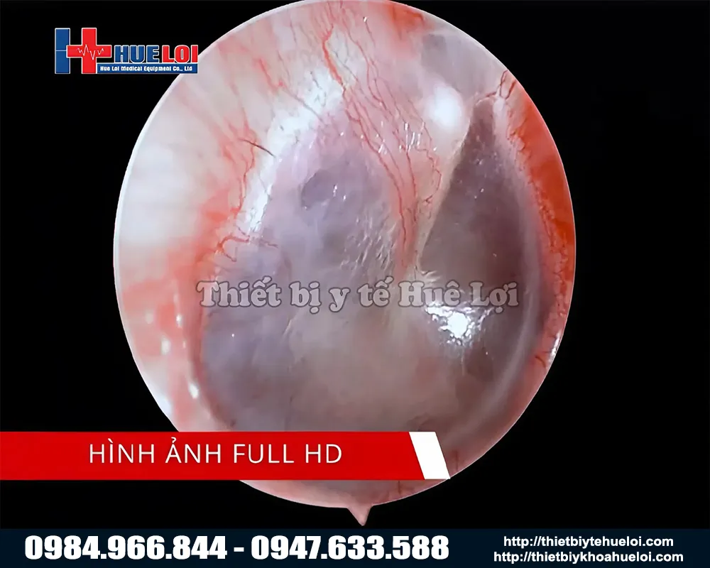 Máy nội soi tai mũi họng hình ảnh