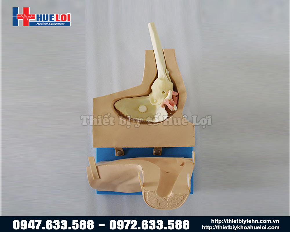 mô hình phẫu thuật nội soi khớp vai